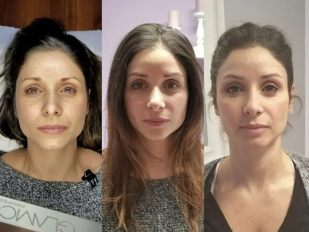 What is Microblading